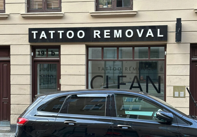 Borttagna tatueringar het trend